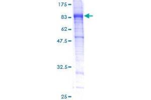 Image no. 1 for Integrin alpha FG-GAP Repeat Containing 3 (ITFG3) (AA 1-552) protein (GST tag) (ABIN1308159) (ITFG3 Protein (AA 1-552) (GST tag))