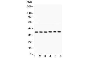 Western blot testing of Heme Oxygenase 2 antibody and Lane 1:  rat kidney;  2: human A549;  3: (h) COLO320;  4: (h) MM231;  5: (h) HeLa;  6: (h) SKOV. (HMOX2 抗体  (AA 2-316))