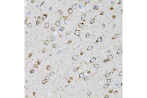 Immunohistochemistry of paraffin-embedded rat brain using UBE2D1 antibody (ABIN5971011) at dilution of 1/100 (40x lens). (UBE2D1 抗体)