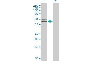 Western Blot analysis of ACPP expression in transfected 293T cell line by ACPP MaxPab polyclonal antibody. (ACPP 抗体  (AA 1-386))