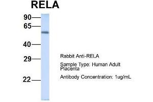 Host: Rabbit  Target Name: RELA  Sample Tissue: Human Adult Placenta  Antibody Dilution: 1. (NF-kB p65 抗体  (Middle Region))