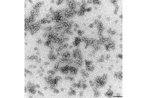 Transmission electron microscopy (TEM) image for Hepatitis B Virus Surface Antigen (HBsAg) protein-VLP (ABIN7540346)