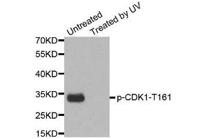 Western Blotting (WB) image for anti-Cyclin-Dependent Kinase 1 (CDK1) (pTyr15) antibody (ABIN1870049) (CDK1 抗体  (pTyr15))