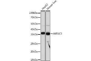 Western blot analysis of extracts of various cell lines, using C3 Rabbit mAb (ABIN1680027, ABIN3018233, ABIN3018234 and ABIN7101584) at 1:1000 dilution. (AKR1C3 抗体)