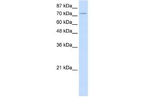 WB Suggested Anti-ZNF441 Antibody Titration:  1. (ZNF441 抗体  (N-Term))