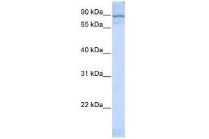 Western Blot showing ZNF598 antibody used at a concentration of 1-2 ug/ml to detect its target protein. (ZNF598 抗体  (Middle Region))