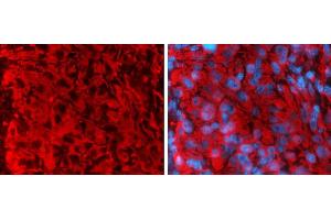 Immunohistochemistry (IHC) image for anti-Vimentin (VIM) antibody (ABIN2854814)