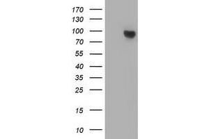 Western Blotting (WB) image for anti-Catenin (Cadherin-Associated Protein), beta 1, 88kDa (CTNNB1) antibody (ABIN1496895) (CTNNB1 抗体)