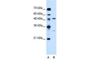 Image no. 1 for anti-Colony Stimulating Factor 1 (Macrophage) (CSF1) (N-Term) antibody (ABIN6736671) (M-CSF/CSF1 抗体  (N-Term))