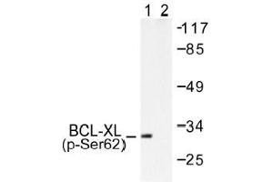 Image no. 1 for anti-BCL2-Like 1 (BCL2L1) (pSer62) antibody (ABIN317973) (BCL2L1 抗体  (pSer62))