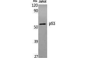 Western Blot analysis of various cells using p53 Polyclonal Antibody diluted at 1:1000. (p53 抗体)