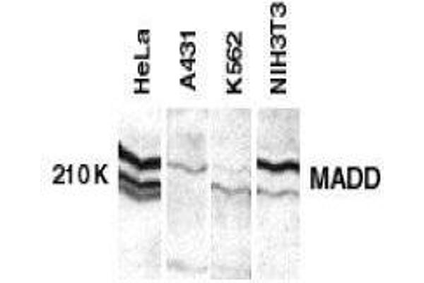 MADD 抗体  (C-Term)