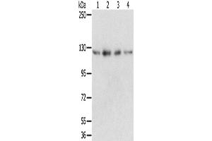 Western Blotting (WB) image for anti-RNA Binding Motif Protein 5 (RBM5) antibody (ABIN2424058) (RBM5 抗体)