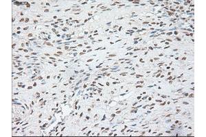 Immunohistochemistry (IHC) image for anti-POU Class 5 Homeobox 1 (POU5F1) antibody (ABIN1500354) (OCT4 抗体)