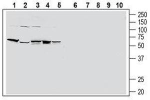 Western blot analysis of human HT-29 colon adenocarcinoma cell line lysate (lanes 1 and 6), human PANC-1 pancreatic carcinoma cell line lysate (lanes 2 and 7), human THP-1 monocytic leukemia cell line lysate (lanes 3 and 8), human Jurkat T-cell leukemia cell line lysate (lanes 4 and 9) and human MCF-7 breast adenocarcinoma cell line lysate (lanes 5 and 10): - 1-5. (F2RL1 抗体  (Extracellular, N-Term))