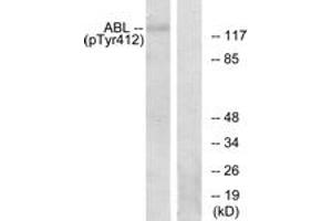 Western Blotting (WB) image for anti-C-Abl Oncogene 1, Non-Receptor tyrosine Kinase (ABL1) (pTyr393) antibody (ABIN2888351) (ABL1 抗体  (pTyr393))