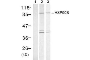 Western blot analysis of extract from HeLa cells, untreated or treated with UV or Heat shock, using HSP90B (Ab-254) antibody (E021290). (HSP90AB1 抗体)