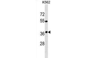 Western Blotting (WB) image for anti-Olfactory Receptor, Family 12, Subfamily D, Member 3 (OR12D3) antibody (ABIN3000173) (OR12D3 抗体)