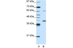 MGC46336 antibody used at 0. (ZNF843 抗体  (N-Term))