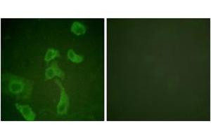 Immunofluorescence (IF) image for anti-Interleukin 2 Receptor, beta (IL2RB) (AA 331-380) antibody (ABIN2888883) (IL2 Receptor beta 抗体  (AA 331-380))