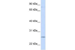 PCDHGC3 antibody used at 1 ug/ml to detect target protein. (Protocadherin gamma Subfamily C, 3 (PCDHGC3) (N-Term) 抗体)