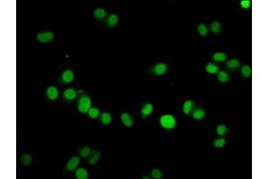 Immunofluorescence staining of Hela cells with ABIN7139605 at 1:7. (HIST1H4A 抗体  (meLys59))
