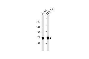 All lanes : Anti-Z Antibody  at 1:1000 dilution Lane 1: Jurkat whole cell lysate Lane 2: MOLT-4 whole cell lysate Lysates/proteins at 20 μg per lane. (ZAP70 抗体  (AA 252-282))