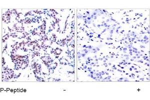 Image no. 1 for anti-Jun B Proto-Oncogene (JUNB) (pSer259) antibody (ABIN196658) (JunB 抗体  (pSer259))