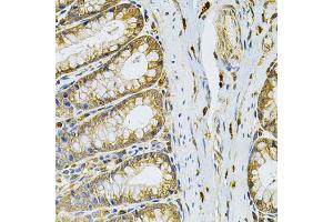 Immunohistochemistry of paraffin-embedded rat intestine using RRAGC Antibody (ABIN4905065) at dilution of 1:100 (40x lens). (GTR2 抗体)