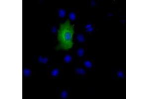 Immunofluorescence (IF) image for anti-Epoxide Hydrolase 2, Cytoplasmic (EPHX2) antibody (ABIN1500857) (EPHX2 抗体)