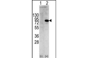 Western blot analysis of PIK3R1 (arrow) using rabbit polyclonal PIK3R1 Antibody  f. (PIK3R1 抗体  (AA 558-587))