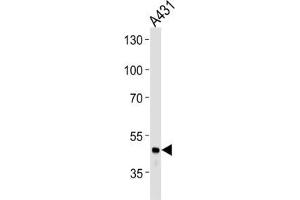 Western Blotting (WB) image for anti-Fibrinogen gamma Chain (FGG) antibody (ABIN3003142) (FGG 抗体)