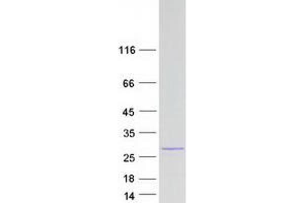 CLLD6 Protein (Transcript Variant 1) (Myc-DYKDDDDK Tag)