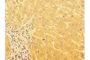 Immunohistochemistry of paraffin-embedded human liver tissue using ABIN7164477 at dilution of 1:100 (GPR179 抗体  (AA 1440-1671))