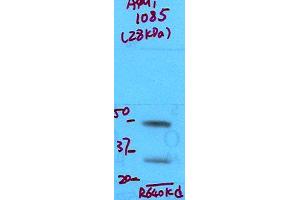 Western Blotting (WB) image for anti-Aquaporin 1 (Colton Blood Group) (AQP1) (N-Term) antibody (ABIN6656923)