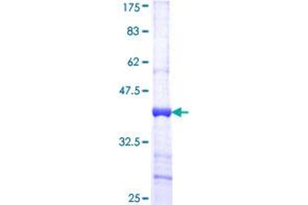 CPM Protein (AA 251-349) (GST tag)