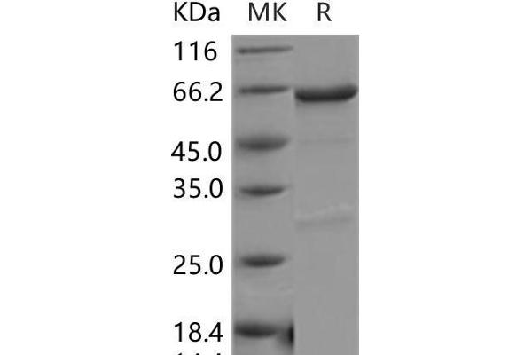 PDK4 Protein (GST tag,His tag)