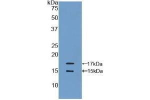 Detection of Recombinant MCP1, Human using Polyclonal Antibody to Monocyte Chemotactic Protein 1 (MCP1) (CCL2 抗体  (AA 24-99))