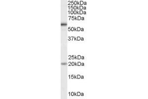 Image no. 1 for anti-Bone Morphogenetic Protein Receptor 1A (BMPR1A) (Internal Region) antibody (ABIN374667) (BMPR1A 抗体  (Internal Region))