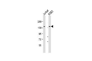 Western Blot at 1:2000 dilution Lane 1: Jurkat whole cell lysate Lane 2: K562 whole cell lysate Lysates/proteins at 20 ug per lane. (TACC3 抗体  (AA 498-530))