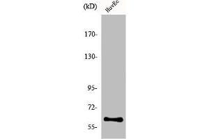 Western Blot analysis of COLO205 cells using hnRNP LL Polyclonal Antibody (HNRPLL 抗体  (Internal Region))