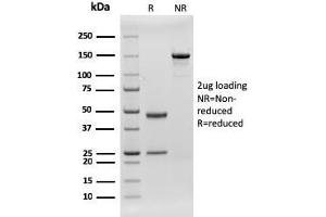 SDS-PAGE Analysis Purified CD79b Recombinant Mouse Monoclonal Antibody (rIGB/1842). (Recombinant CD79b 抗体  (AA 29-159))