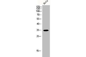 Western Blot analysis of HELA cells using p35 Polyclonal Antibody (CDK5R1 抗体  (N-Term))