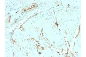 Immunohistochemistry (IHC) image for anti-CD34 (CD34) antibody (ABIN6941175)