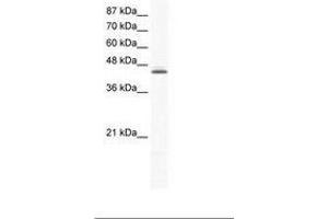 Image no. 1 for anti-ALX Homeobox 4 (ALX4) (C-Term) antibody (ABIN6736020) (ALX4 抗体  (C-Term))