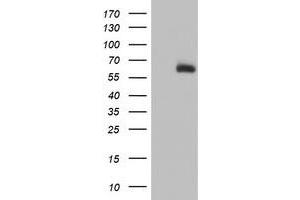 Western Blotting (WB) image for anti-ACSM5 / MACS3 antibody (ABIN1496425) (ACSM5 / MACS3 抗体)