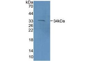 Western blot analysis of recombinant Mouse PCDH15. (PCDH15 抗体  (AA 45-270))