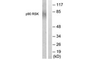 Western blot analysis of extracts from 293 cells, treated with PMA 125ng/ml 30', using p90 RSK (Ab-380) Antibody. (RPS6KA3 抗体  (AA 346-395))