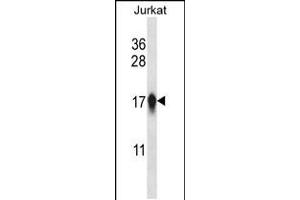 Western blot analysis in Jurkat cell line lysates (35ug/lane). (CENPA 抗体  (AA 82-110))