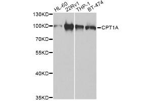 Western blot analysis of extracts of various cell lines, using CPT1A Antibody. (CPT1A 抗体)